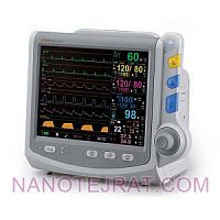 مانیتورینگ ECG مانیتورینگ ECG